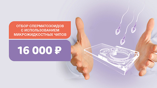 Отбор сперматозоидов на микрожидкостных чипах Fertile®: повысим шансы на успешное ЭКО. Скидка 20%